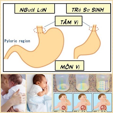 bộ tiêu hóa cho trẻ sơ sinh