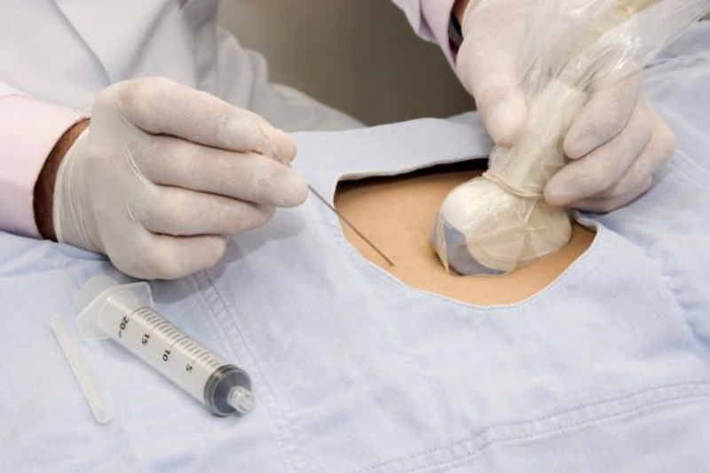 Tầm soát gen bệnh ở người bình thường