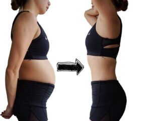 Giảm mỡ bụng sau sinh 