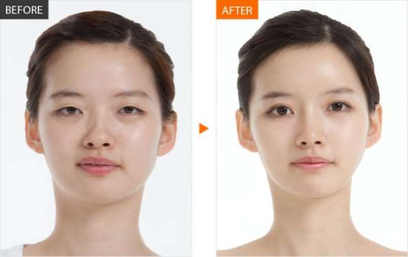 Massage nâng cơ mặt mang đến rất nhiều lợi ích