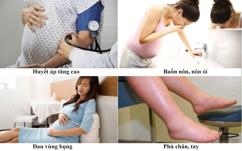 Top 5 Tai biến sản khoa nguy hiểm nhất