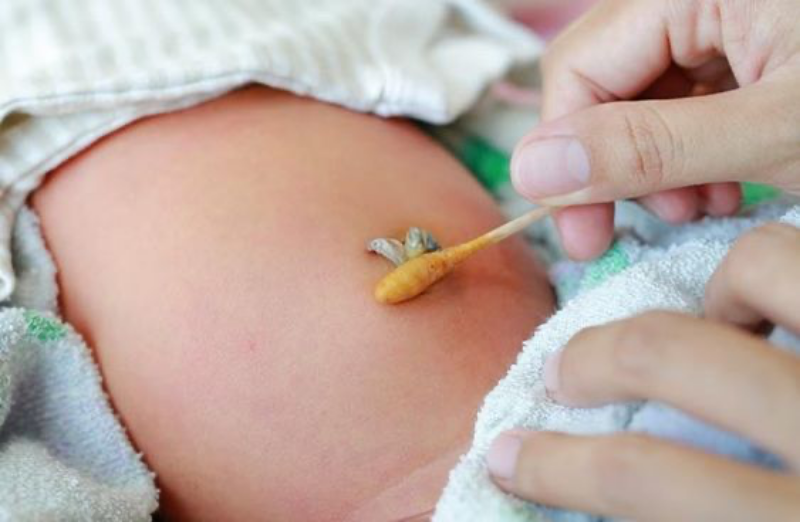 5+ dấu hiệu mẹ cần lưu ý trong thời gian rụng rốn