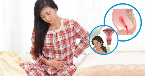 Mẹ bỉm sau sinh bao lâu thì hết sản dịch
