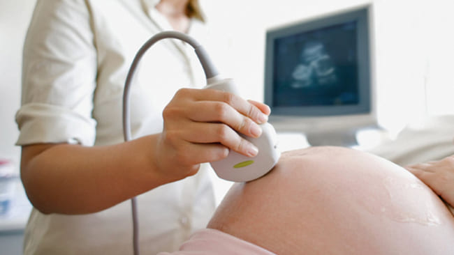 Siêu âm cho kết quả chẩn đoán dị tật bẩm sinh chính xác