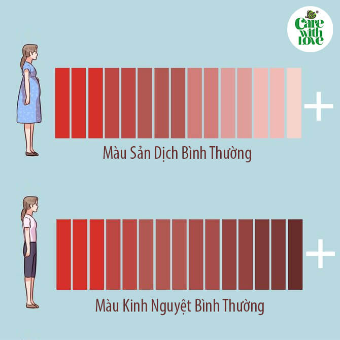 theo dõi sản dịch sau sinh