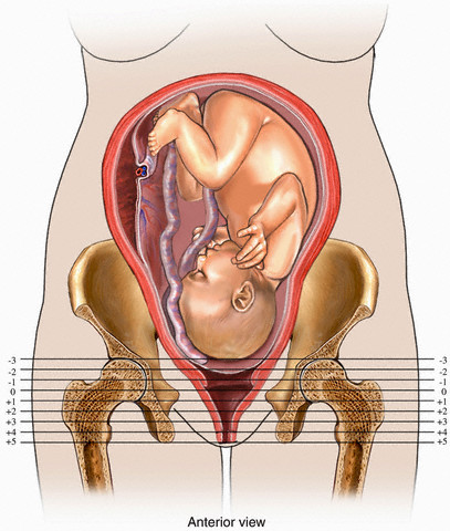 Stations of Presentation During labor