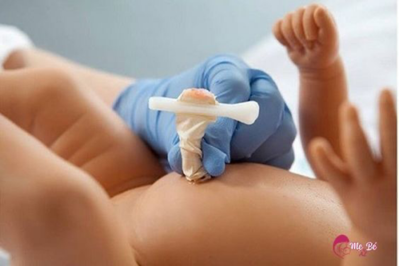 Ba mẹ cần chú ý nên thấy bé rụng rốn muộn
