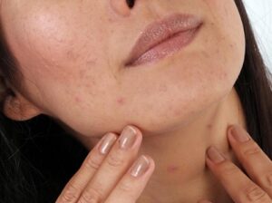 bí quyết làm đẹp sau sinh cho làn da rạng rỡ, bi quyet lam dep sau sinh cho lan da rang ro