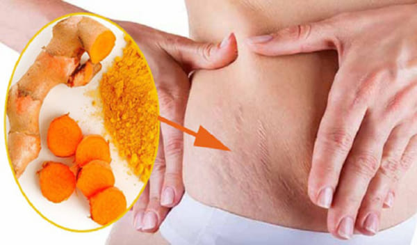 làm đẹp sau sinh bằng nghệ - 2