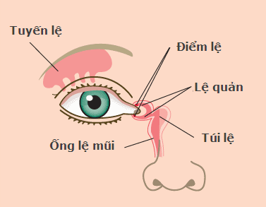 Tắc tuyến lệ ở trẻ sơ sinh là như thế nào