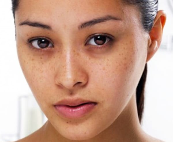 Vì sao làm đẹp da mặt sau sinh trở nên cần thiết