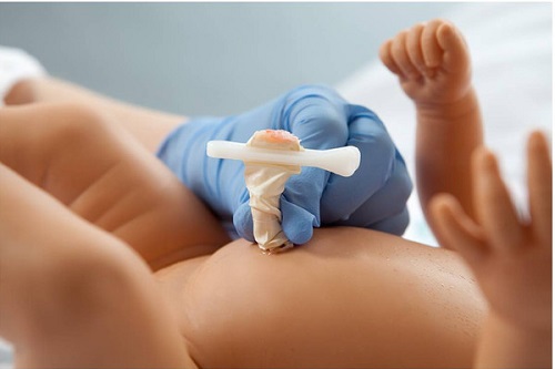 Loại bỏ nguy hiểm từ nhiễm trùng rốn